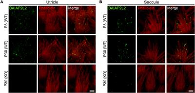 BAIAP2L2 Inactivation Does Not Affect Stereocilia Development or Maintenance in Vestibular Hair Cells